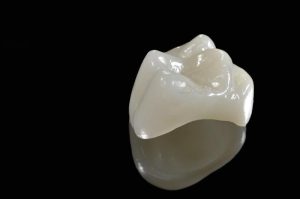 columbia dental crowns